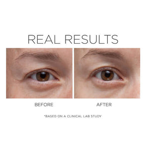 COSMEDIX Opti Crystal Eye Serum